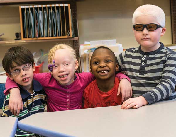 Group of children with various visual impairments